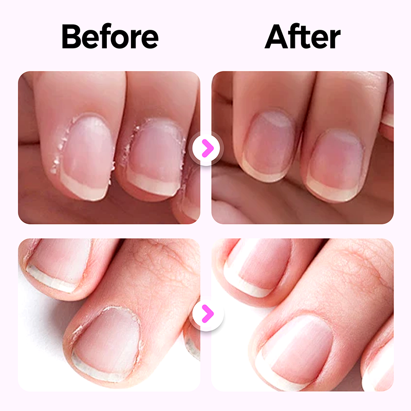 Upgraded 3-in-1 Nail Care Pen💅