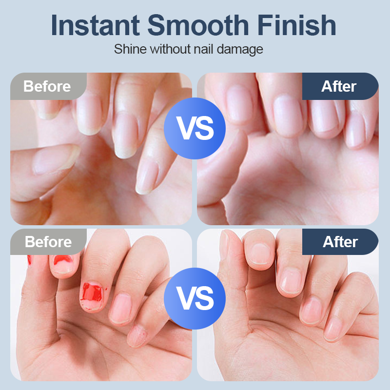 Automatic Fingernail Grinder